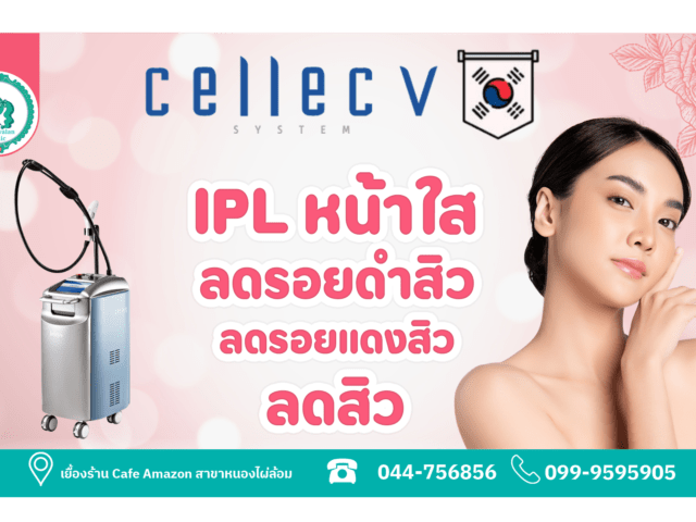 IPL Cellecv