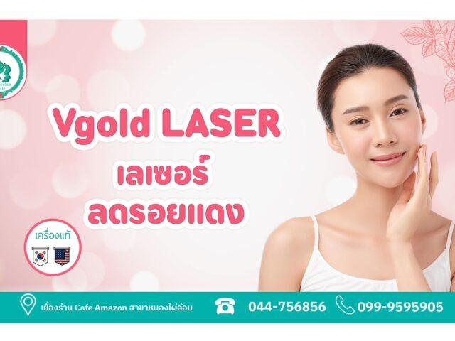 V gold Laser 